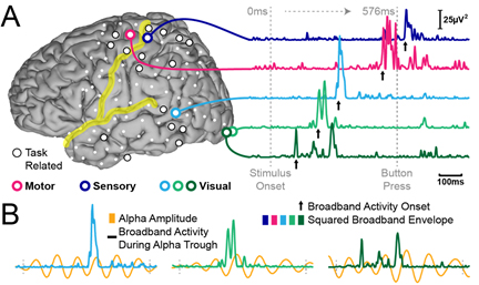 EEG یا نوار مغزی