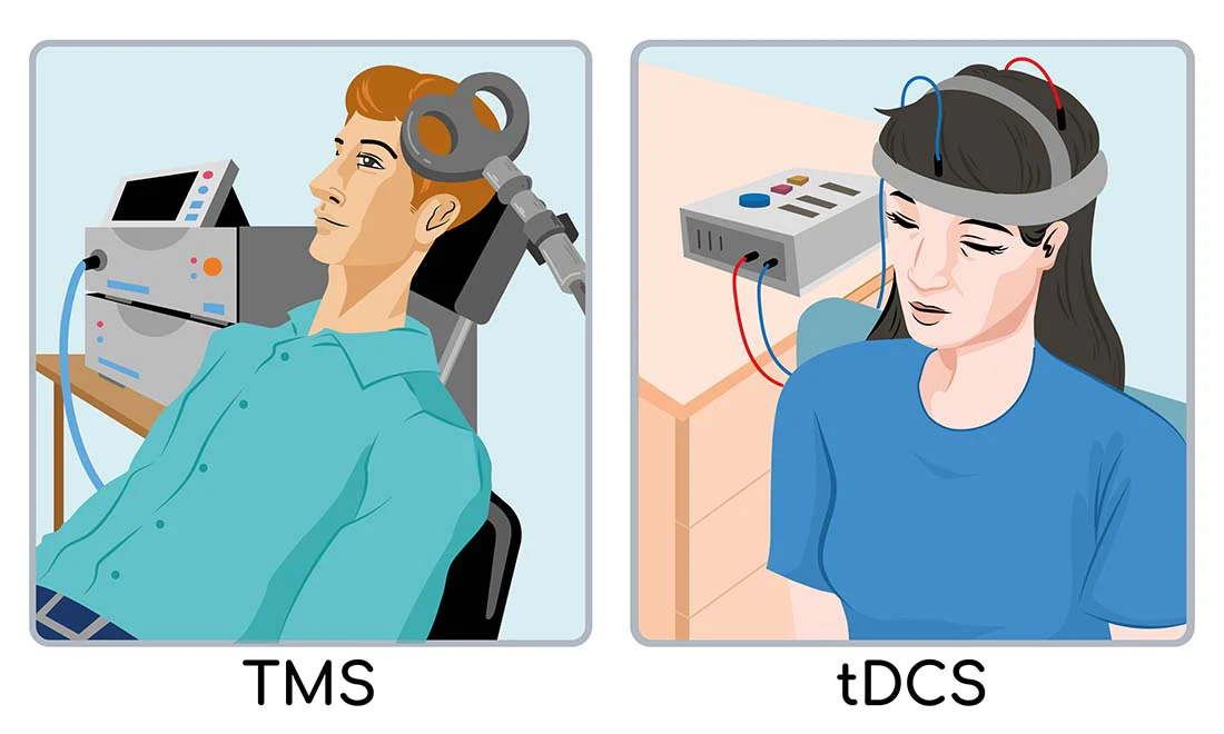 تفاوت بین tDCS و TMS